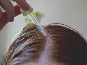 Perfect Essential Oils for Head Lice and Tick Removal
